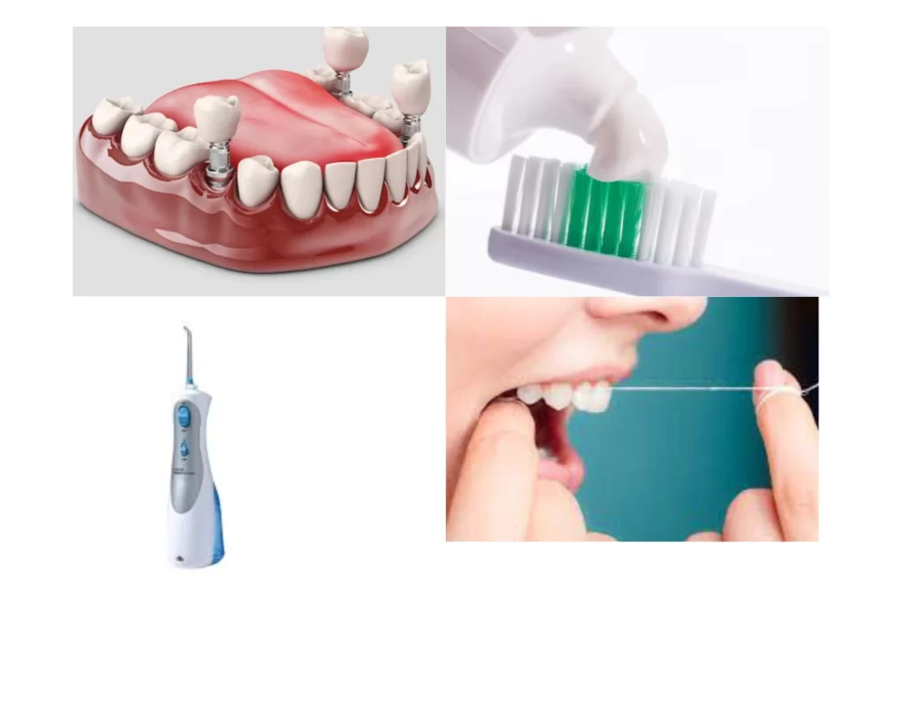 How To Clean Dental Bridge